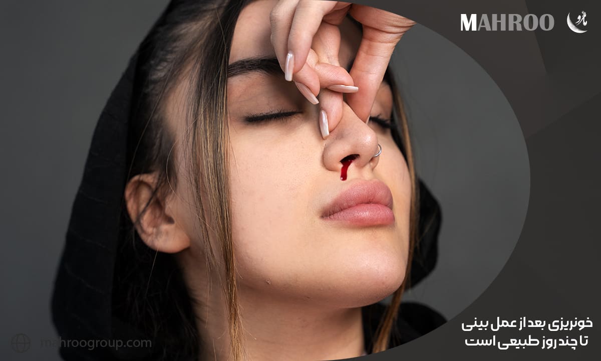 خونریزی بعد از عمل بینی تا چند روز طبیعی است